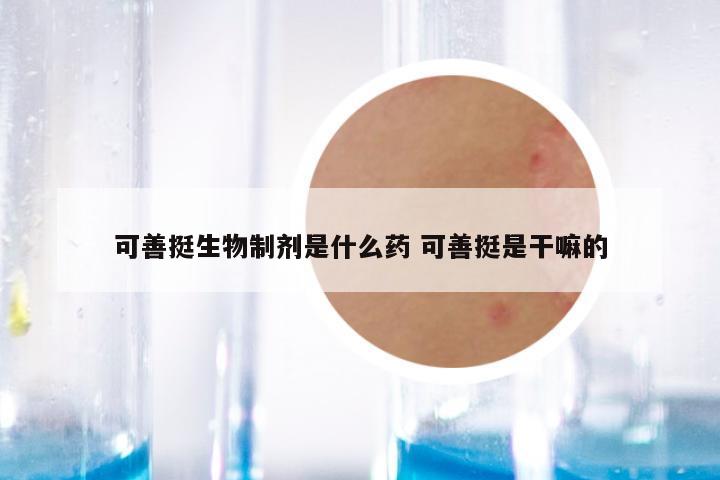 可善挺生物制剂是什么药 可善挺是干嘛的