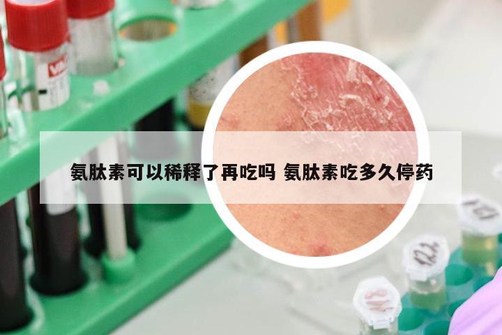 氨肽素可以稀释了再吃吗 氨肽素吃多久停药