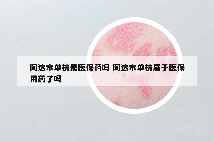 阿达木单抗是医保药吗 阿达木单抗属于医保用药了吗