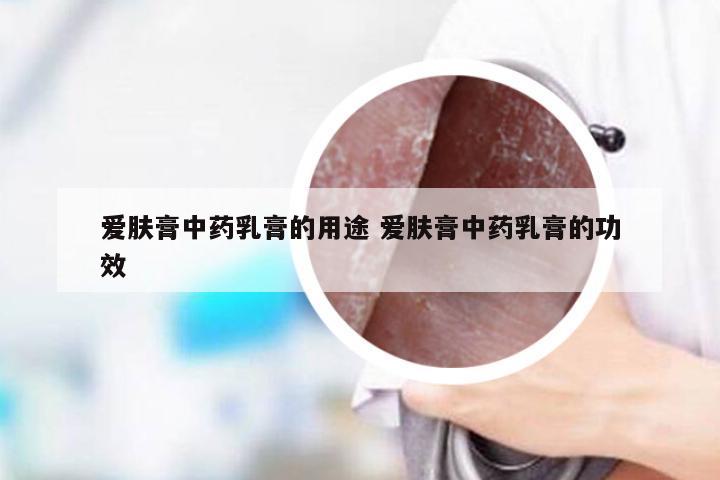 爱肤膏中药乳膏的用途 爱肤膏中药乳膏的功效