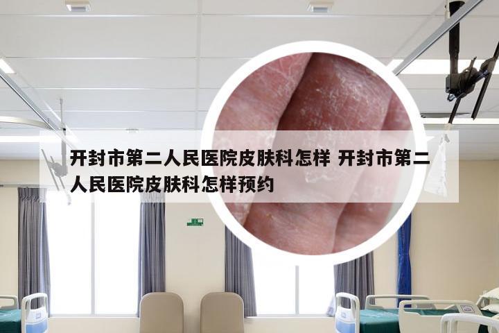 开封市第二人民医院皮肤科怎样 开封市第二人民医院皮肤科怎样预约