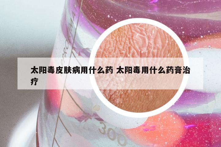 太阳毒皮肤病用什么药 太阳毒用什么药膏治疗