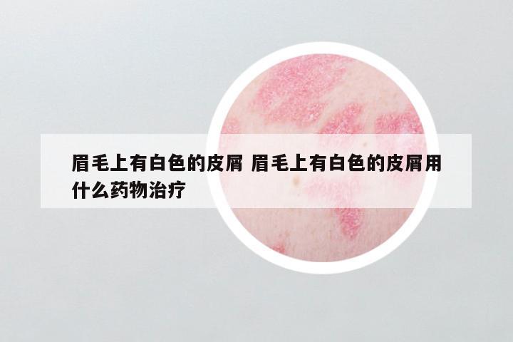 眉毛上有白色的皮屑 眉毛上有白色的皮屑用什么药物治疗