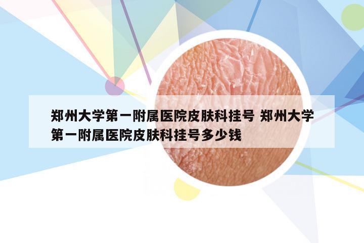 郑州大学第一附属医院皮肤科挂号 郑州大学第一附属医院皮肤科挂号多少钱