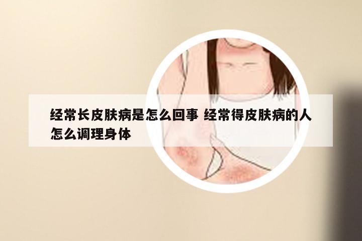 经常长皮肤病是怎么回事 经常得皮肤病的人怎么调理身体