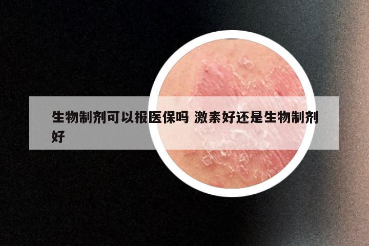 生物制剂可以报医保吗 激素好还是生物制剂好