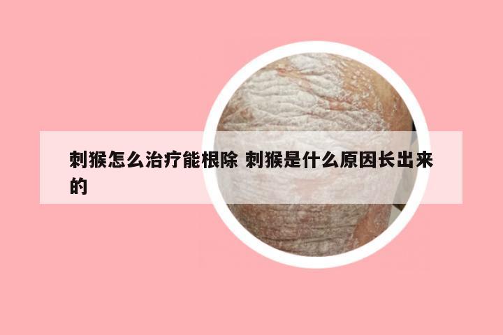 刺猴怎么治疗能根除 刺猴是什么原因长出来的