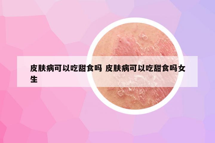 皮肤病可以吃甜食吗 皮肤病可以吃甜食吗女生