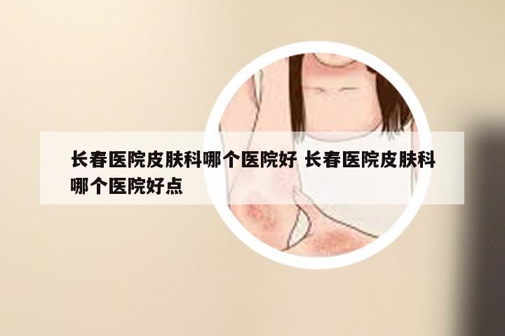 长春医院皮肤科哪个医院好 长春医院皮肤科哪个医院好点