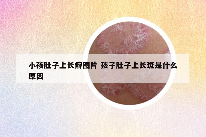 小孩肚子上长癣图片 孩子肚子上长斑是什么原因