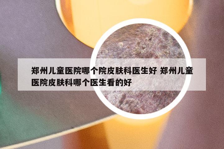 郑州儿童医院哪个院皮肤科医生好 郑州儿童医院皮肤科哪个医生看的好