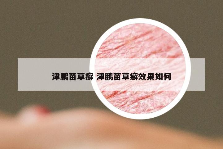 津鹏苗草癣 津鹏苗草癣效果如何