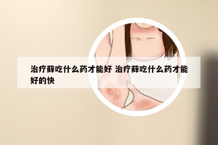 治疗藓吃什么药才能好 治疗藓吃什么药才能好的快