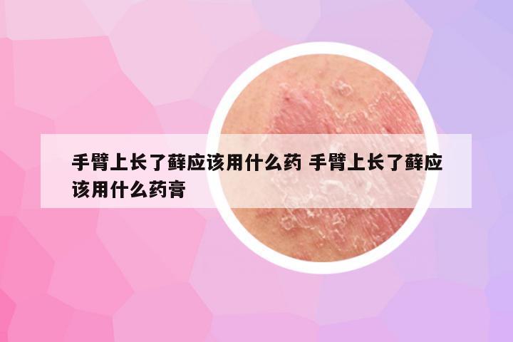 手臂上长了藓应该用什么药 手臂上长了藓应该用什么药膏