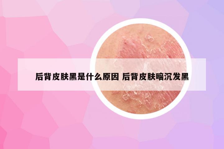 后背皮肤黑是什么原因 后背皮肤暗沉发黑