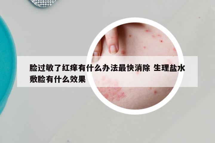 脸过敏了红痒有什么办法最快消除 生理盐水敷脸有什么效果