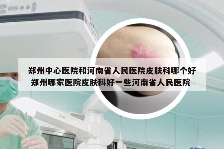 郑州中心医院和河南省人民医院皮肤科哪个好 郑州哪家医院皮肤科好一些河南省人民医院