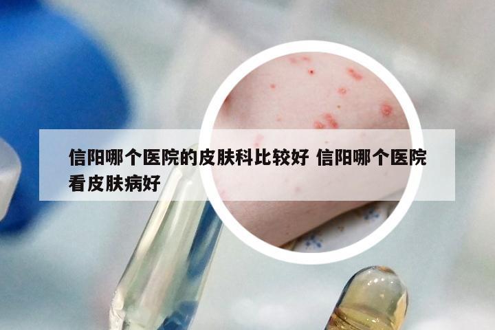 信阳哪个医院的皮肤科比较好 信阳哪个医院看皮肤病好