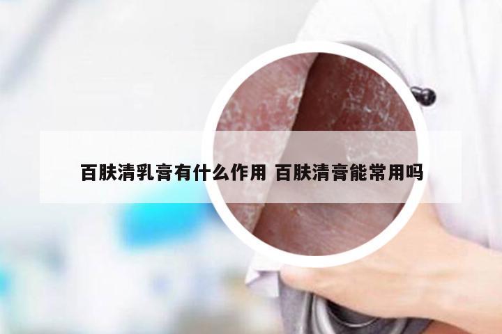 百肤清乳膏有什么作用 百肤清膏能常用吗