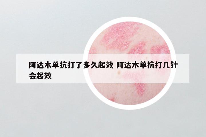 阿达木单抗打了多久起效 阿达木单抗打几针会起效