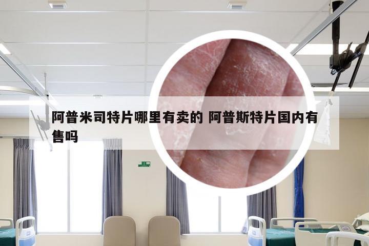 阿普米司特片哪里有卖的 阿普斯特片国内有售吗