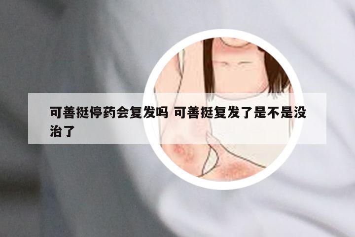 可善挺停药会复发吗 可善挺复发了是不是没治了