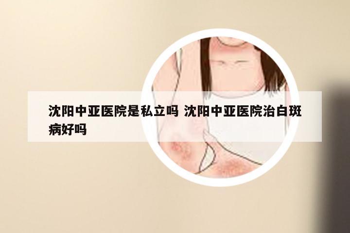 沈阳中亚医院是私立吗 沈阳中亚医院治白斑病好吗