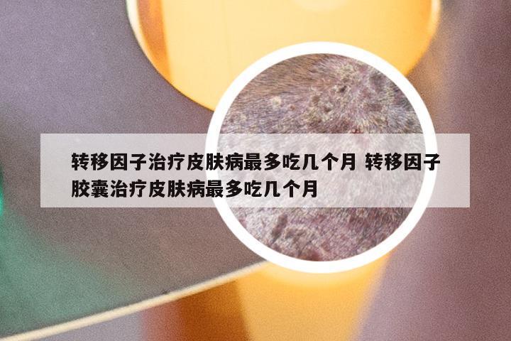 转移因子治疗皮肤病最多吃几个月 转移因子胶囊治疗皮肤病最多吃几个月