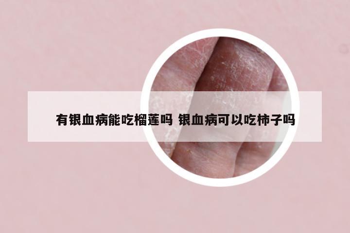 有银血病能吃榴莲吗 银血病可以吃柿子吗