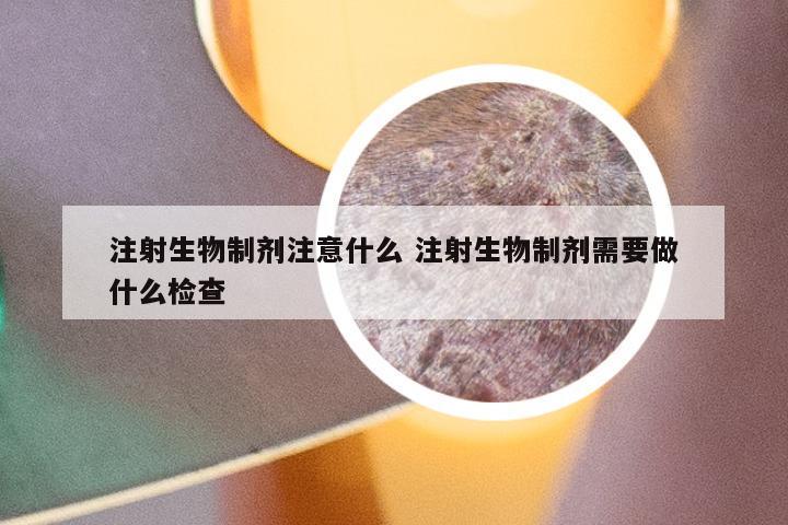 注射生物制剂注意什么 注射生物制剂需要做什么检查