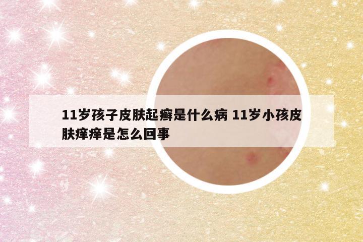 11岁孩子皮肤起癣是什么病 11岁小孩皮肤痒痒是怎么回事