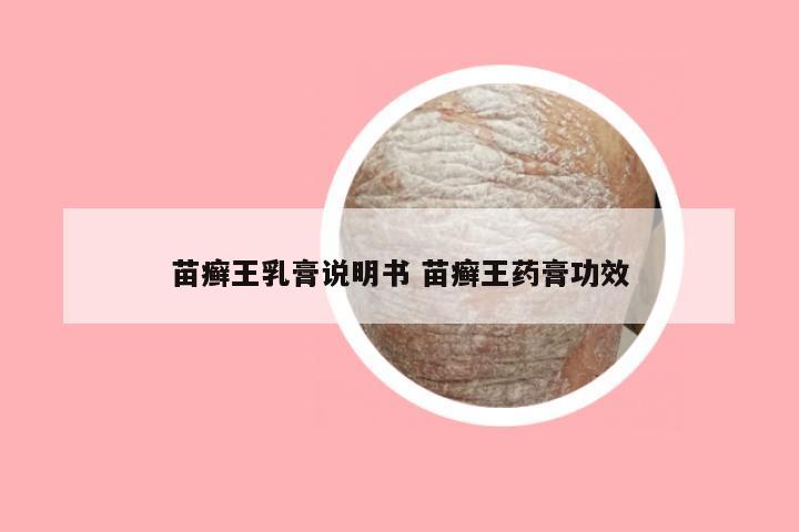 苗癣王乳膏说明书 苗癣王药膏功效