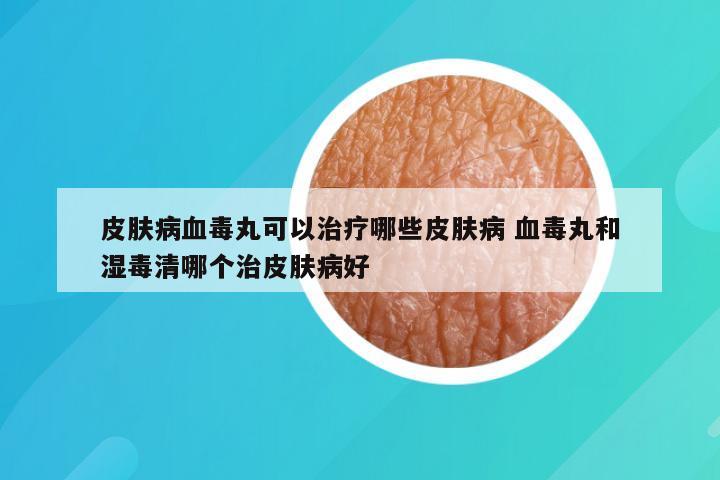 皮肤病血毒丸可以治疗哪些皮肤病 血毒丸和湿毒清哪个治皮肤病好