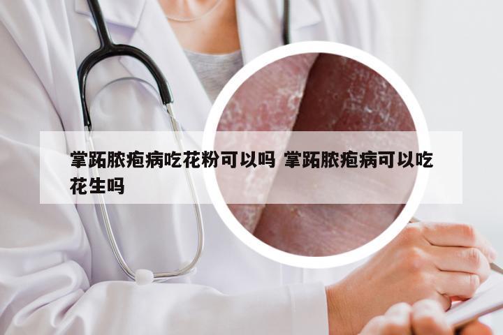 掌跖脓疱病吃花粉可以吗 掌跖脓疱病可以吃花生吗