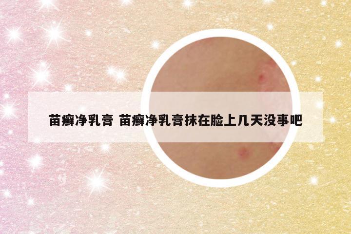 苗癣净乳膏 苗癣净乳膏抹在脸上几天没事吧