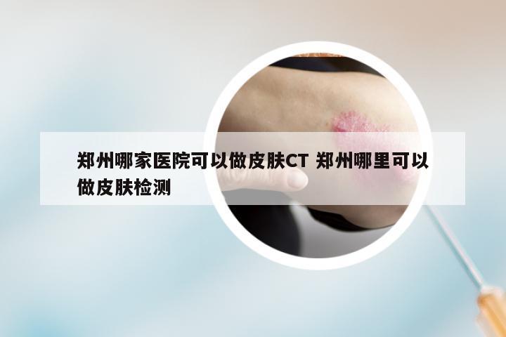 郑州哪家医院可以做皮肤CT 郑州哪里可以做皮肤检测