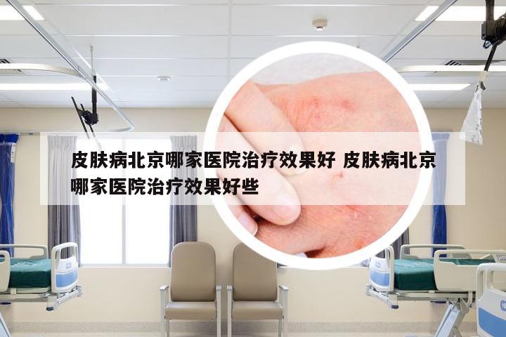 皮肤病北京哪家医院治疗效果好 皮肤病北京哪家医院治疗效果好些