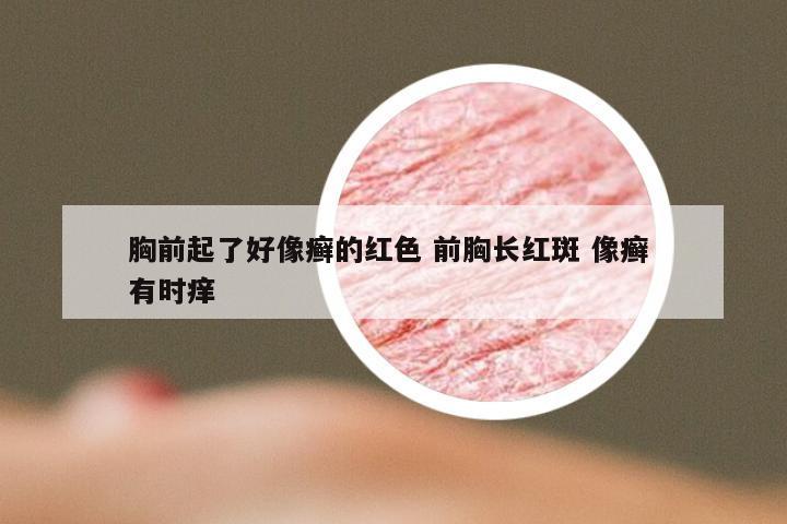 胸前起了好像癣的红色 前胸长红斑 像癣 有时痒