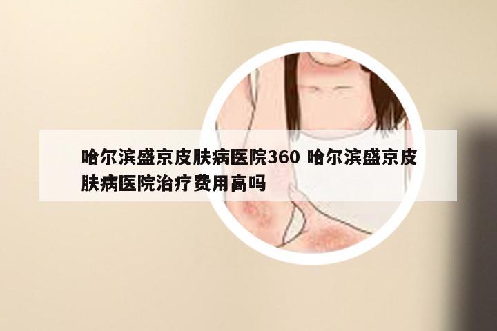 哈尔滨盛京皮肤病医院360 哈尔滨盛京皮肤病医院治疗费用高吗