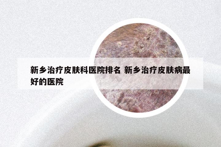 新乡治疗皮肤科医院排名 新乡治疗皮肤病最好的医院