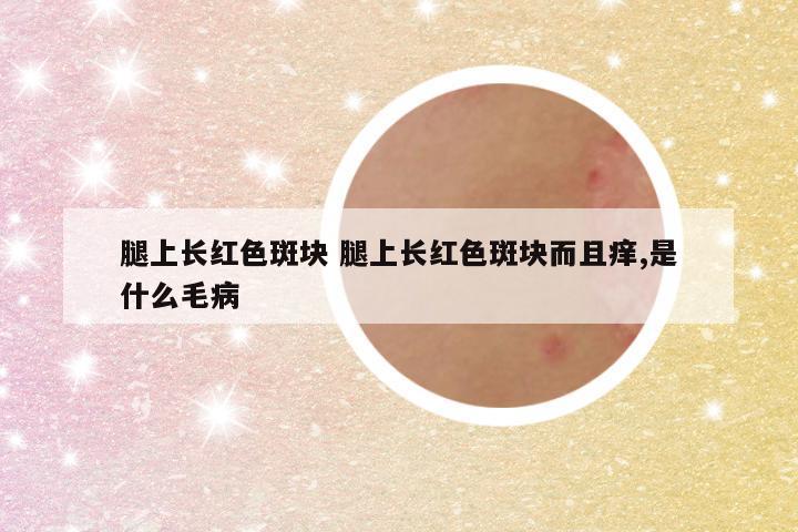 腿上长红色斑块 腿上长红色斑块而且痒,是什么毛病