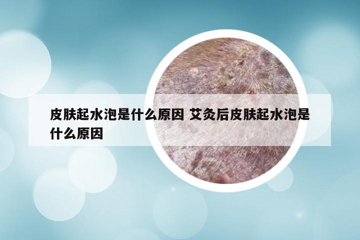 皮肤起水泡是什么原因 艾灸后皮肤起水泡是什么原因