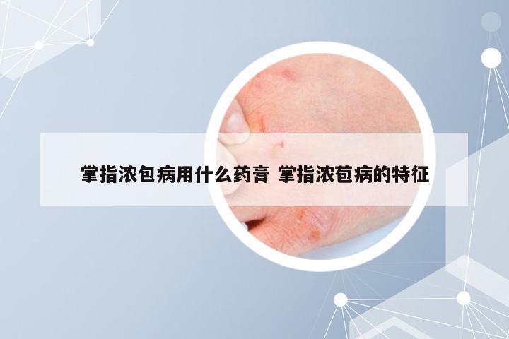 掌指浓包病用什么药膏 掌指浓苞病的特征