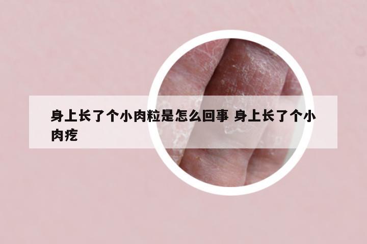 身上长了个小肉粒是怎么回事 身上长了个小肉疙