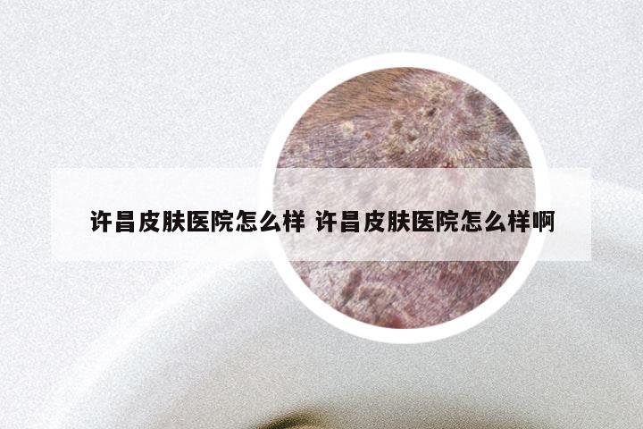 许昌皮肤医院怎么样 许昌皮肤医院怎么样啊