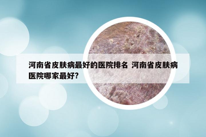 河南省皮肤病最好的医院排名 河南省皮肤病医院哪家最好?