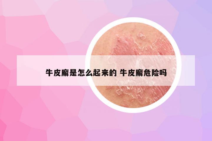 牛皮廨是怎么起来的 牛皮廨危险吗