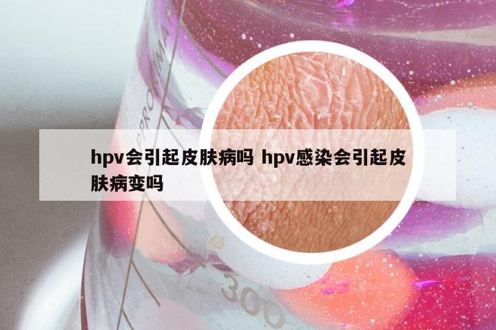 hpv会引起皮肤病吗 hpv感染会引起皮肤病变吗