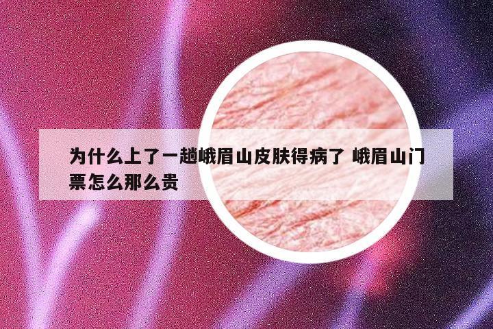 为什么上了一趟峨眉山皮肤得病了 峨眉山门票怎么那么贵