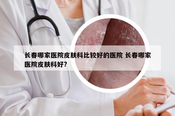 长春哪家医院皮肤科比较好的医院 长春哪家医院皮肤科好?